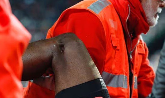 Диахаби получил страшную травму в матче против «Реала»
