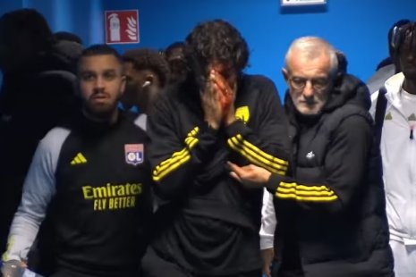 Фанаты «Марселя» разбили голову тренеру «Лиона». Нападений в футболе стало больше